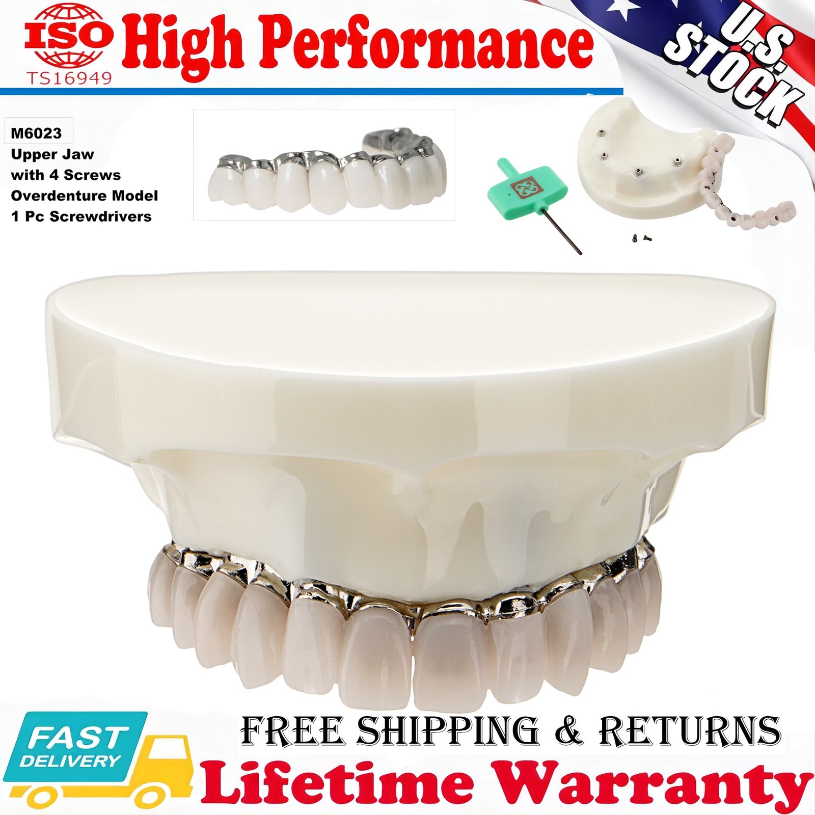 Dental All-on-4 Overdenture Model Dental Upper Jaw Implants Restoration 4 Screws