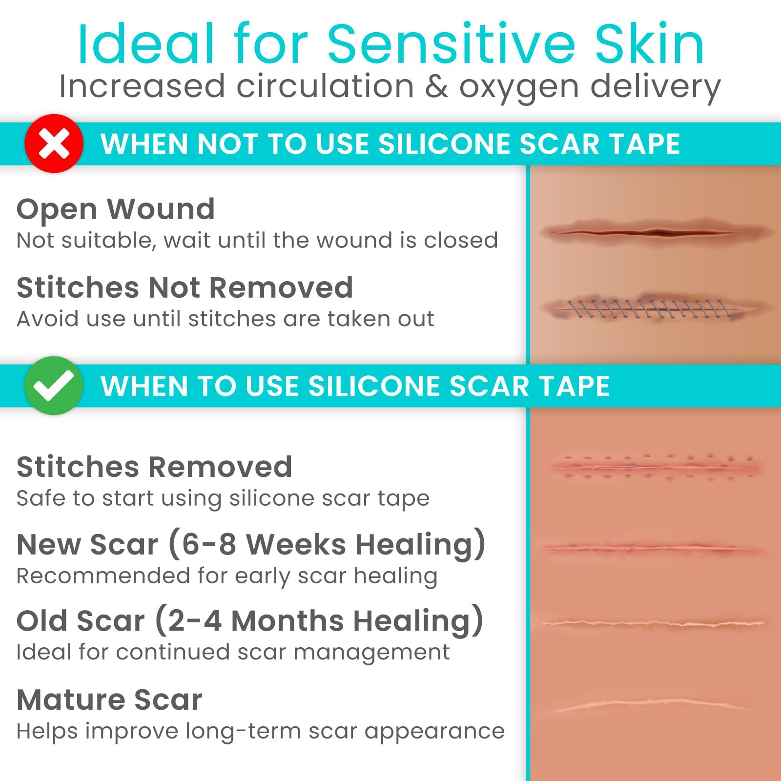 Vive Care Vivecare Silicone Scar Sheets Tape 1.6 X 120 Roll Medical Grade