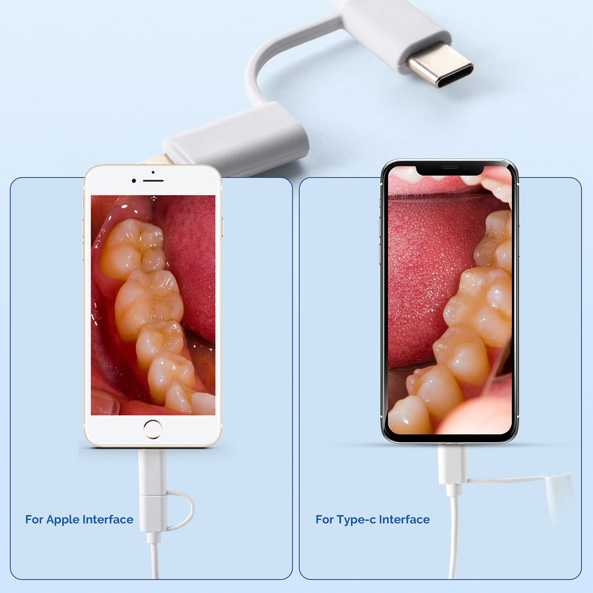AZDENT Dental Intraoral Camera USB HD Camera 13.0 Mega Pixels 6 LED Lights