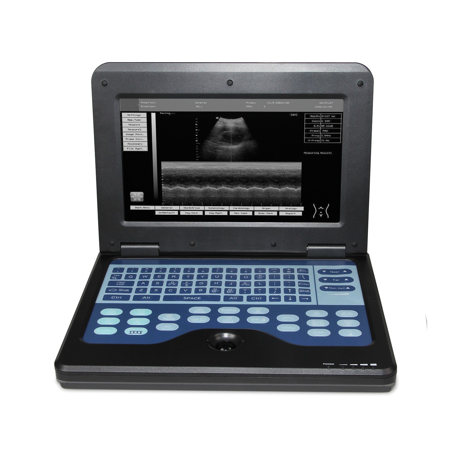 New Portable Ultrasound Scanner Machine Diagnostic System escáner de ultrasonido