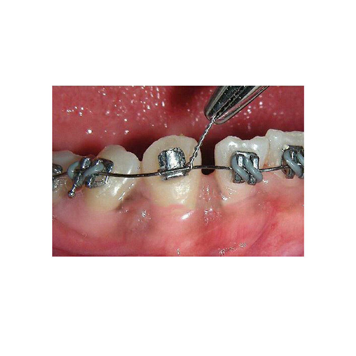 Morelli Dental Orthodontic Stainless Steel CrNi Ligature Wire Spool 50g 203m