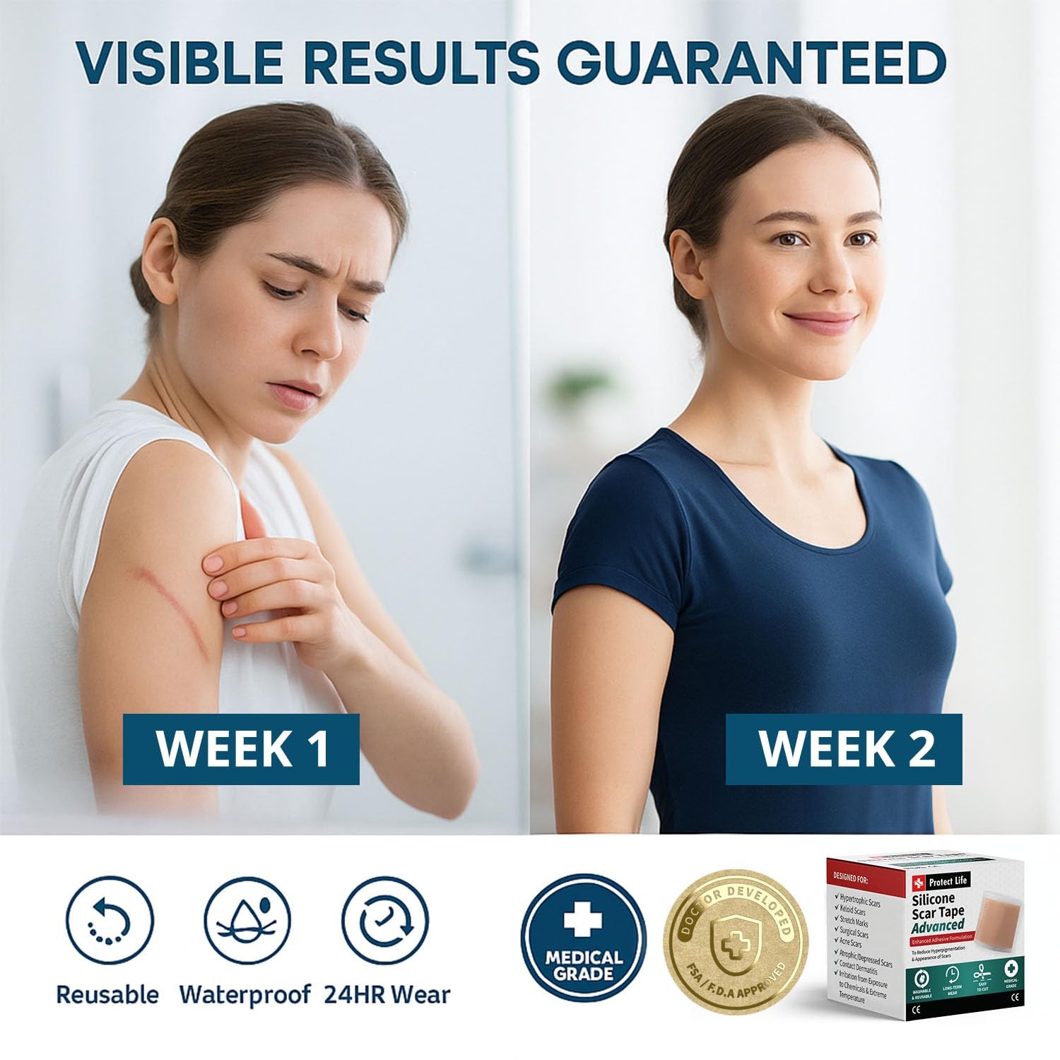 Medical Grade Silicone Scar Tape Advanced 1 pack, Beige Improved Formula