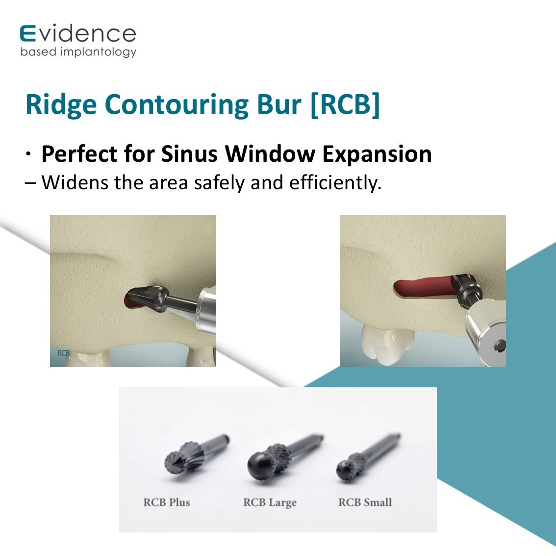 Evidence Implant Ridge Contouring Bur [RCB]