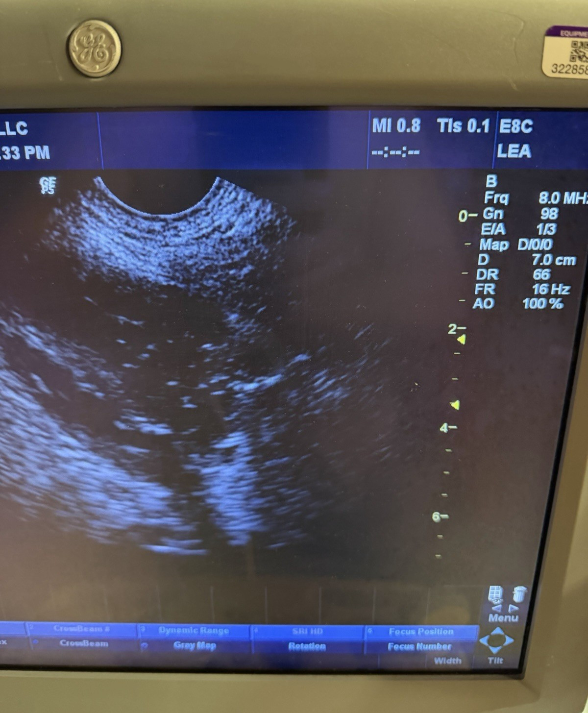 GE Healthcare E8C Endocavitary Ultrasound Probe 2297883 Obstetrics Radiology