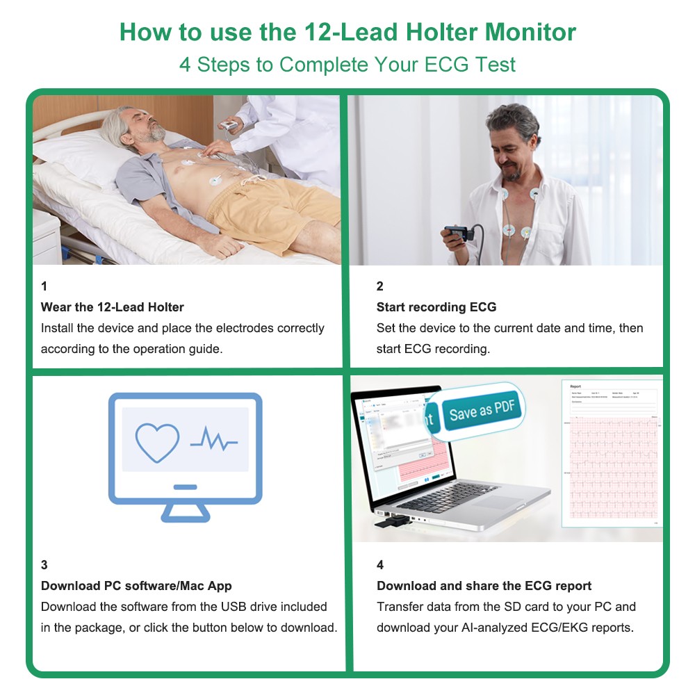 AI Analysis EKG Monitor Heart Monitor 30s/60s/5min Recording with App PC Report