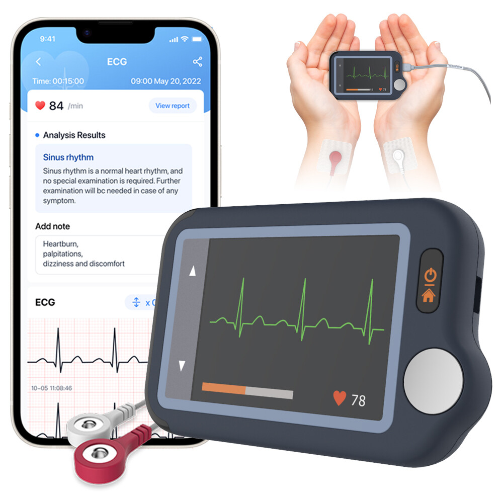 AI Analysis EKG Monitor Heart Monitor 30s/60s/5min Recording with App PC Report