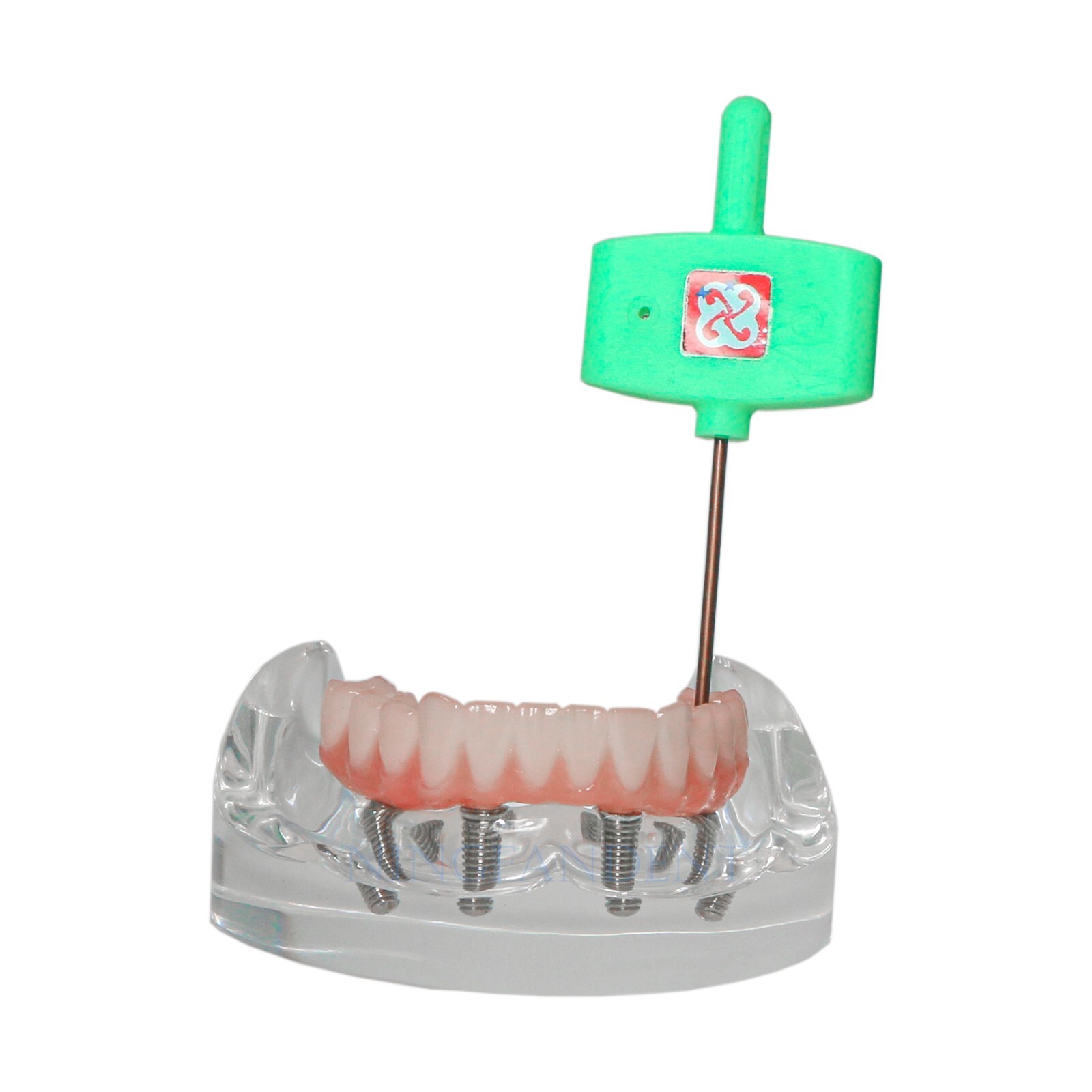 Dental All-on-4 Overdenture Implant Model, Upper/Lower Jaw-Clear,With 4 Screw