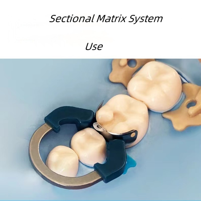 Dental Matrix Bands Ring Sectional Matrice Clamp Fit Garrison Palodent V3 System