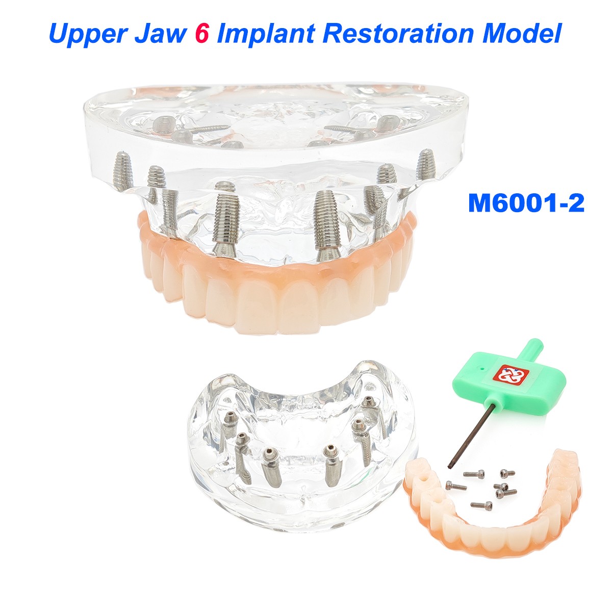 Dental Upper/Lower 4/6 Implants Demo Implant Teeth Model Restoration Overdenture