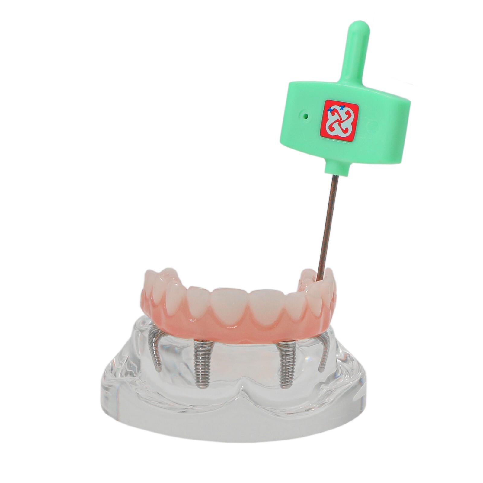 All-on-4/6 Dental Implant Model Upper/Lower Jaw Removable Screws Transparent