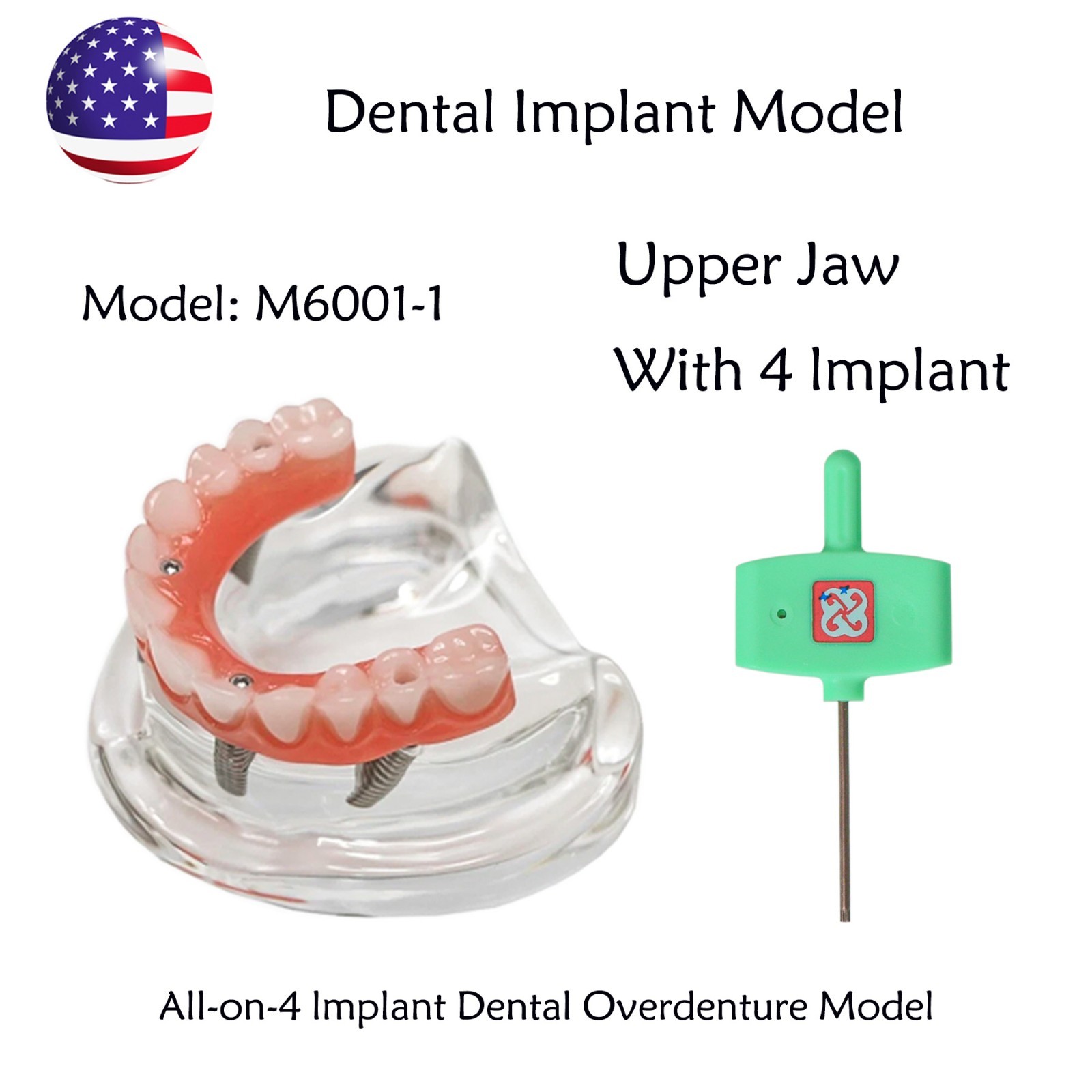 US Dental Implant Overdenture Model All-on-4/6 Upper Jaw Restoration 4/6 Screws