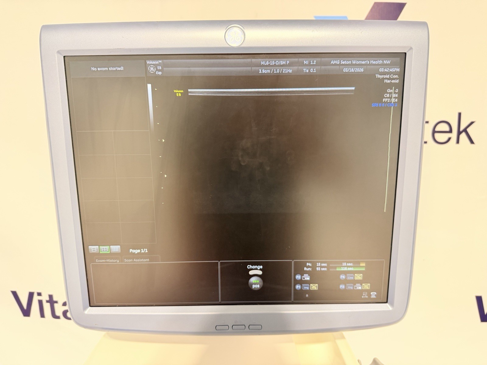 GE Voluson E8 Expert Ultrasound | 2 Probes | 4D HDlive | All Options | Warranty