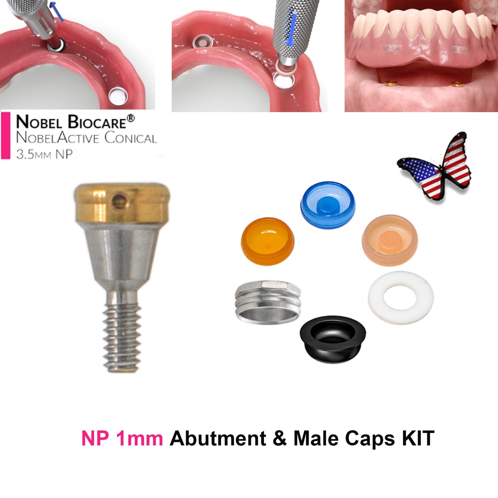 US Locator Accessory For Nobel Dental Core Implant Tool Abutment Cap Replacement