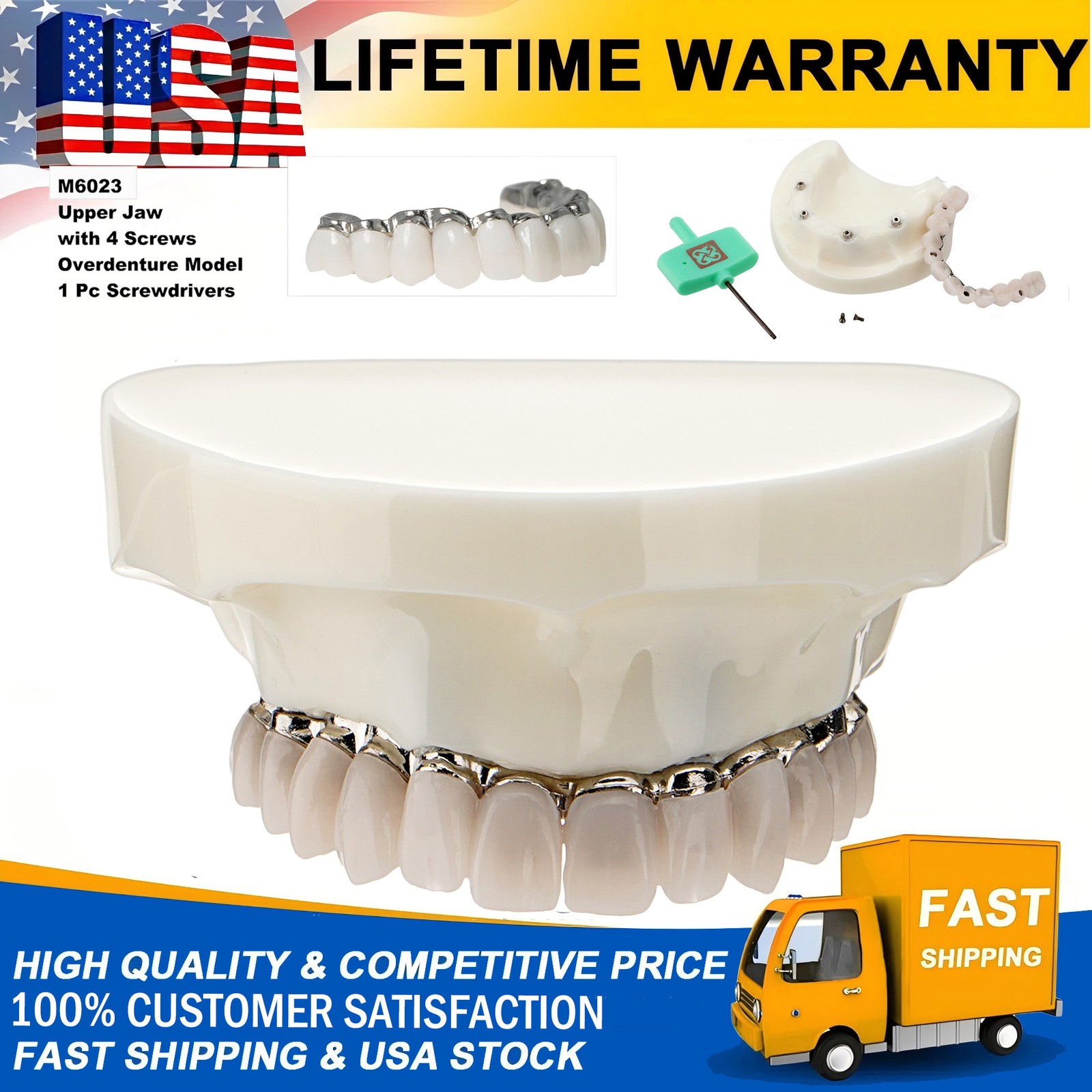 Dental All-on-4 Overdenture Model Upper Jaw Implants Restoration 4 Screws M6023