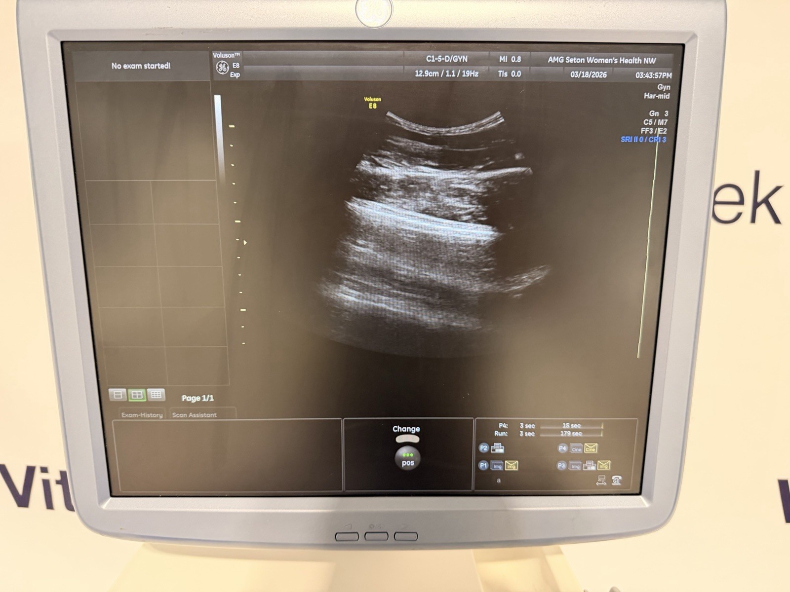 GE Voluson E8 Expert Ultrasound | 2 Probes | 4D HDlive | All Options | Warranty