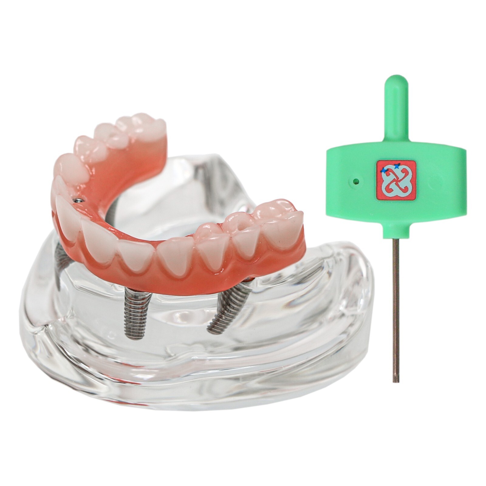 Dental All-on-4 Overdenture Implant Model, Upper/Lower Jaw-Clear,With 4 Screw