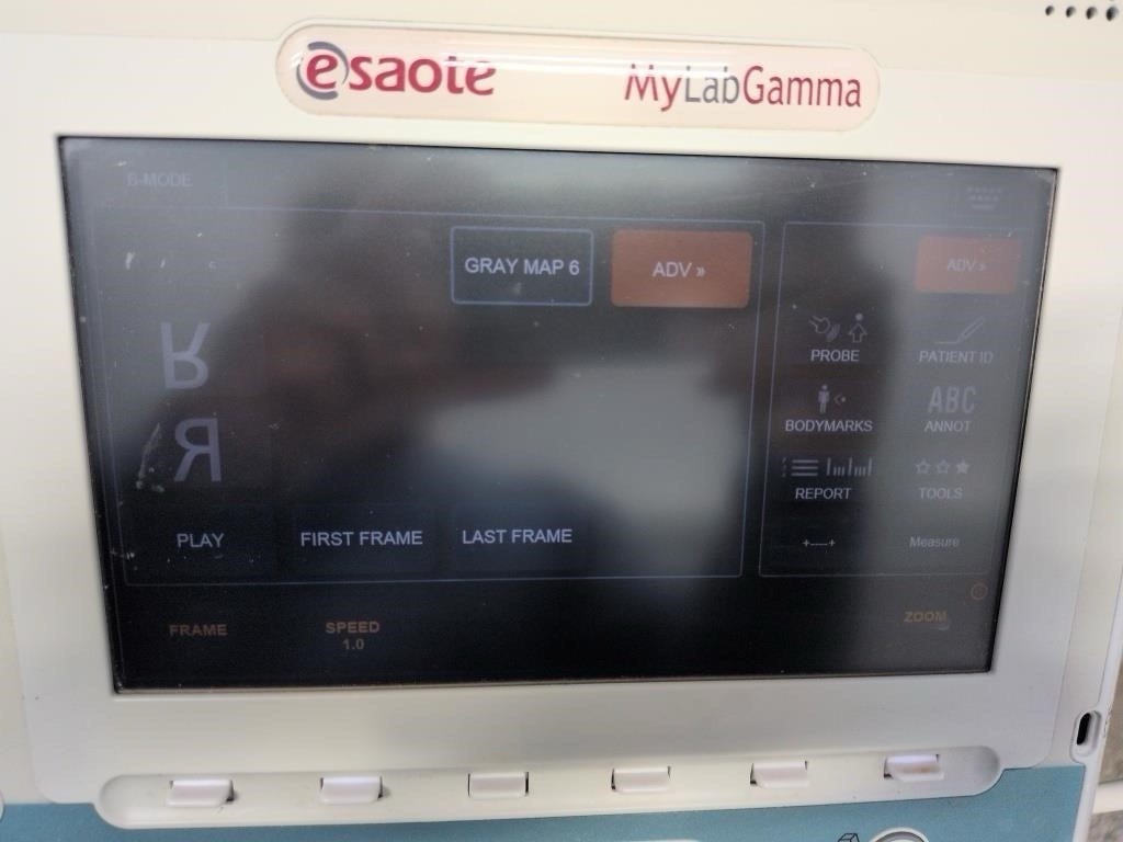 Esaote MyLab Gamma Portable Ultrasound System AC2541 Probe Cart Evo 6.50