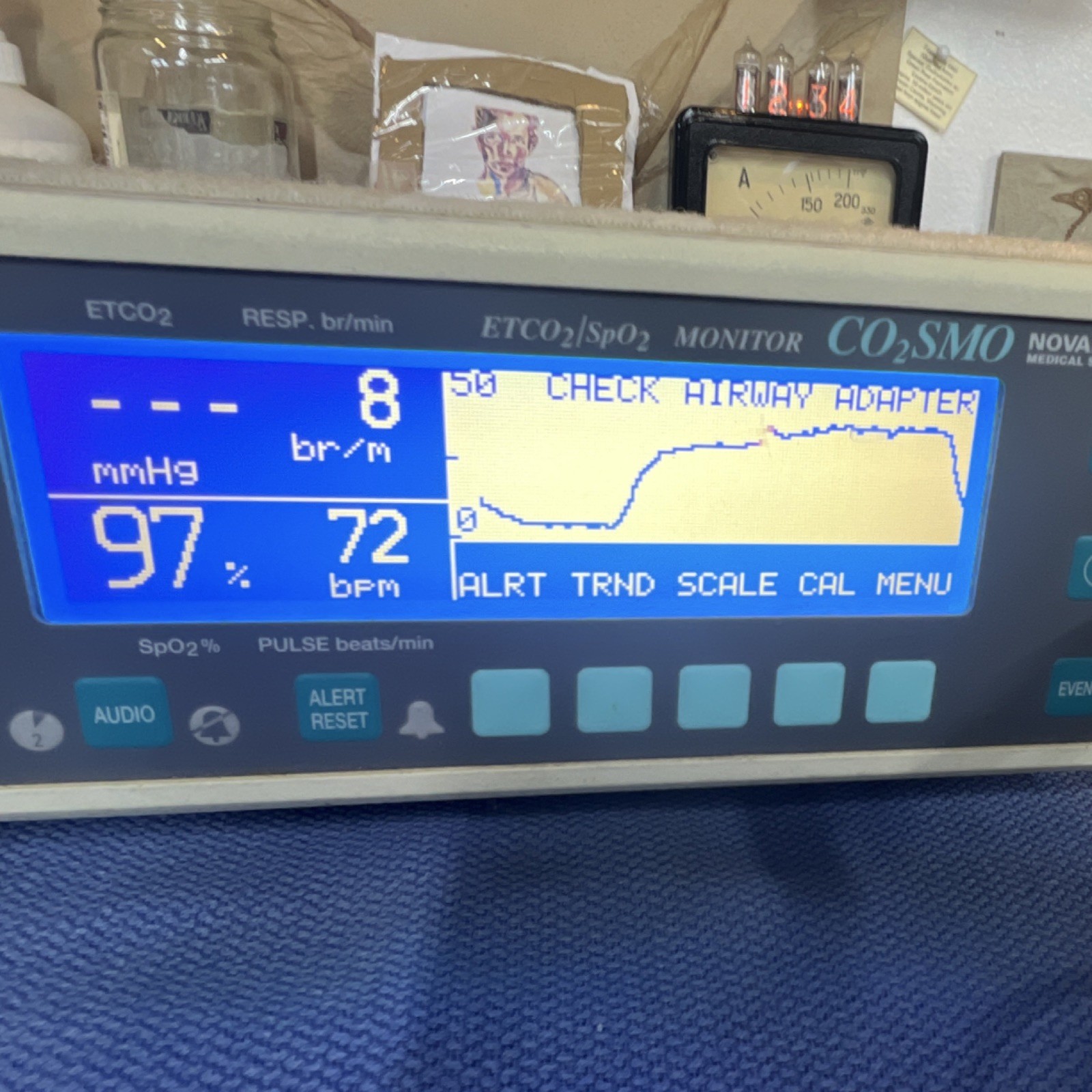 Novametrix CO2SMO 7100 ETCO2 SpO2 Respiration Monitor Battery Operated Printer