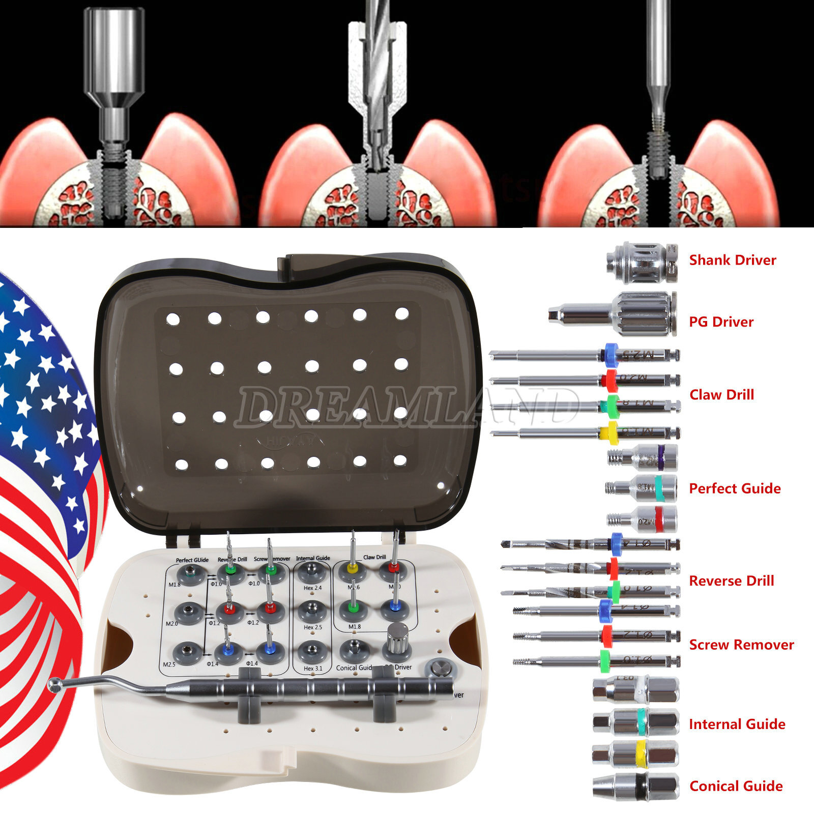 Dental Implant Broken Fractured Screw Removal Kit Drill Guide Remover USA