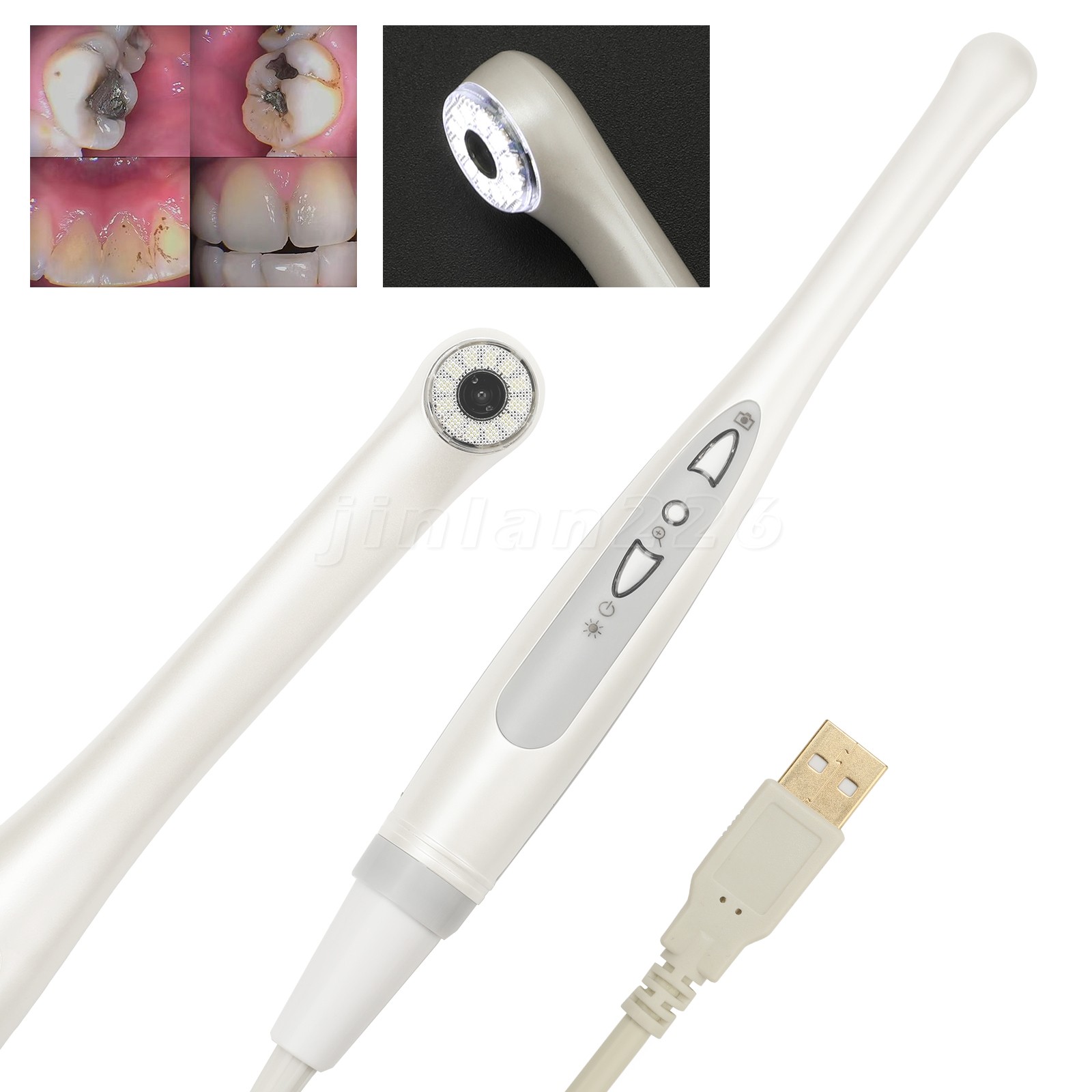 Dental HD Intraoral Camera USB Digital Imaging Work on Dexis/Eaglesoft