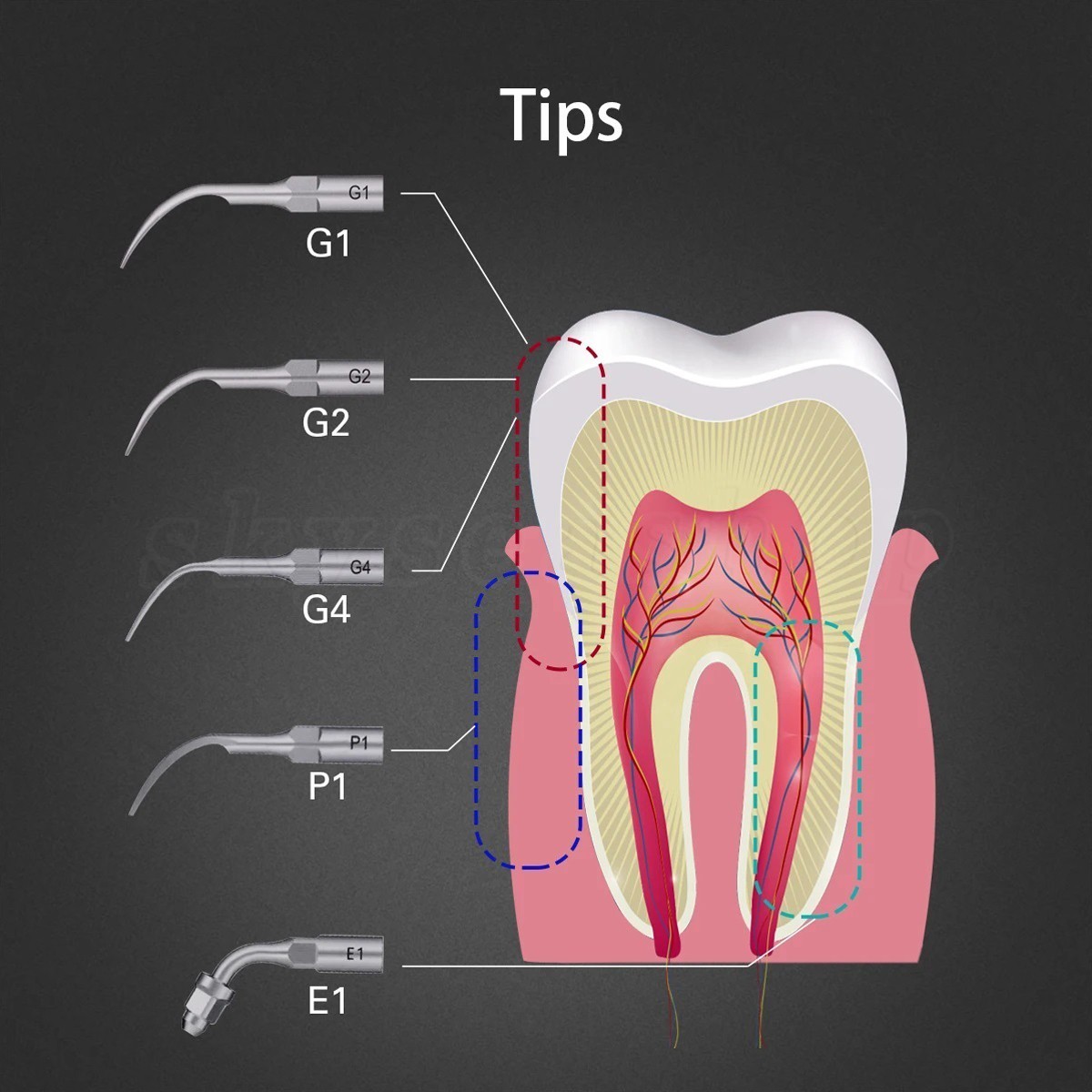 Woodpecker Style Dental Endo Apex Locator Endodontic Root Canal Finder Measure