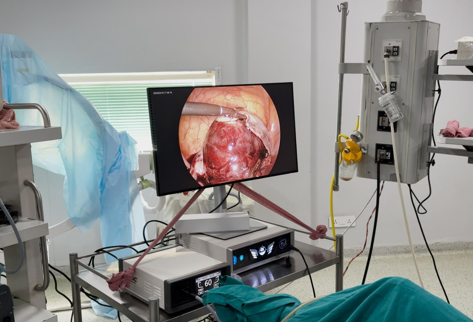 4k Endoscopy Laparoscopic Camera System UHD-LP-6000 Ultra HD Endoscope Camera