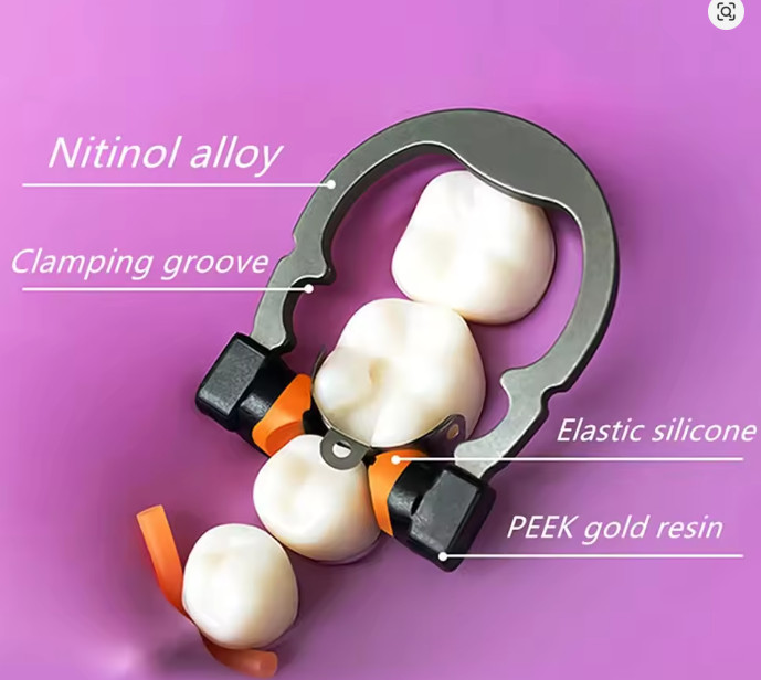 Dental Matrix Bands Ring Sectional Matrice Clamp Fit Garrison Palodent V3 System