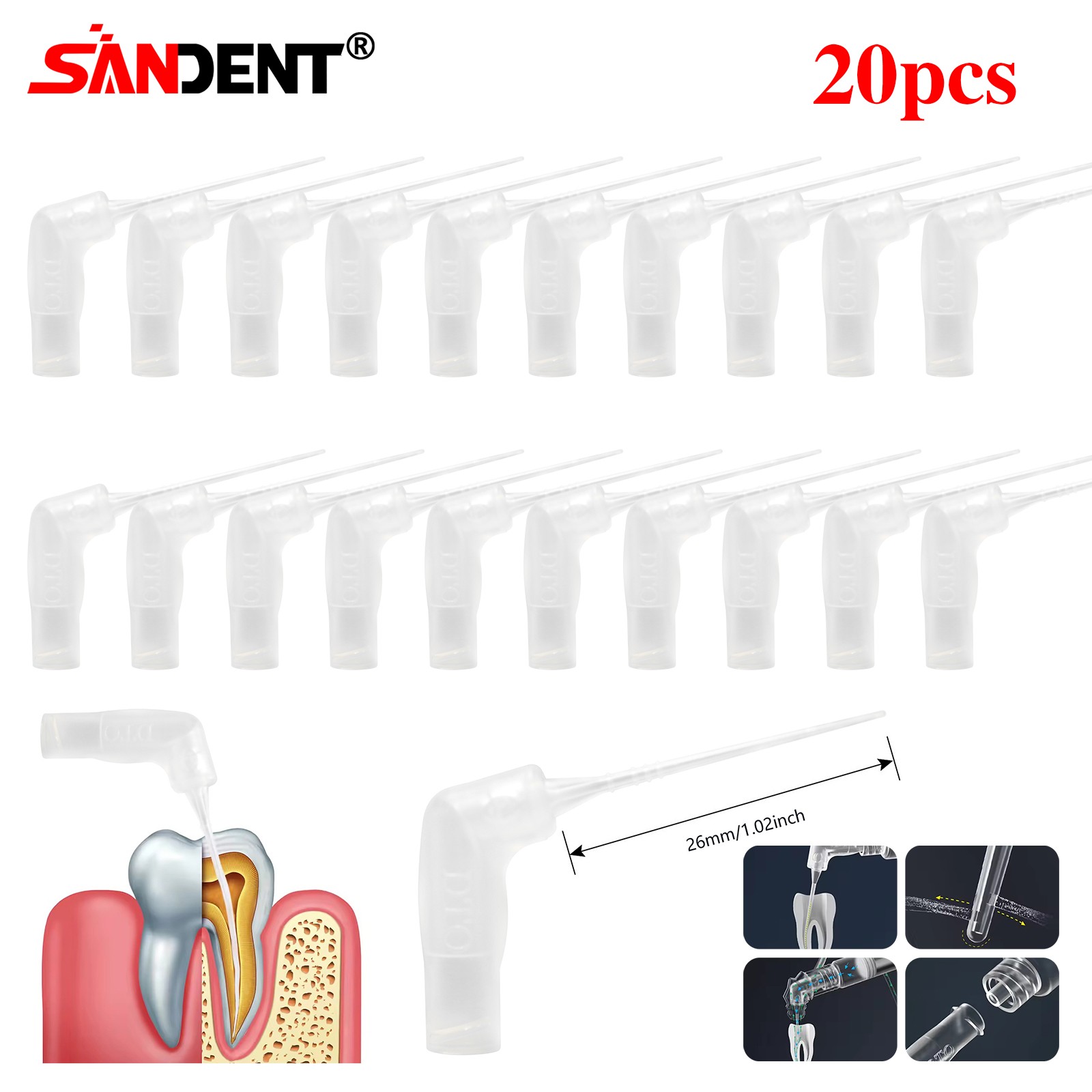 20-400Pcs Dental Endo Root Canal Tip Irrigator Irrigation Needle Tips Flushing