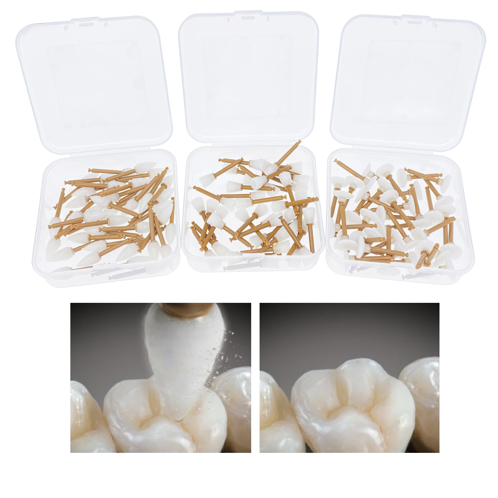 ENHANCE Style Dental Composite Polishing Finishing Finishers RA Cups/Points/Disc