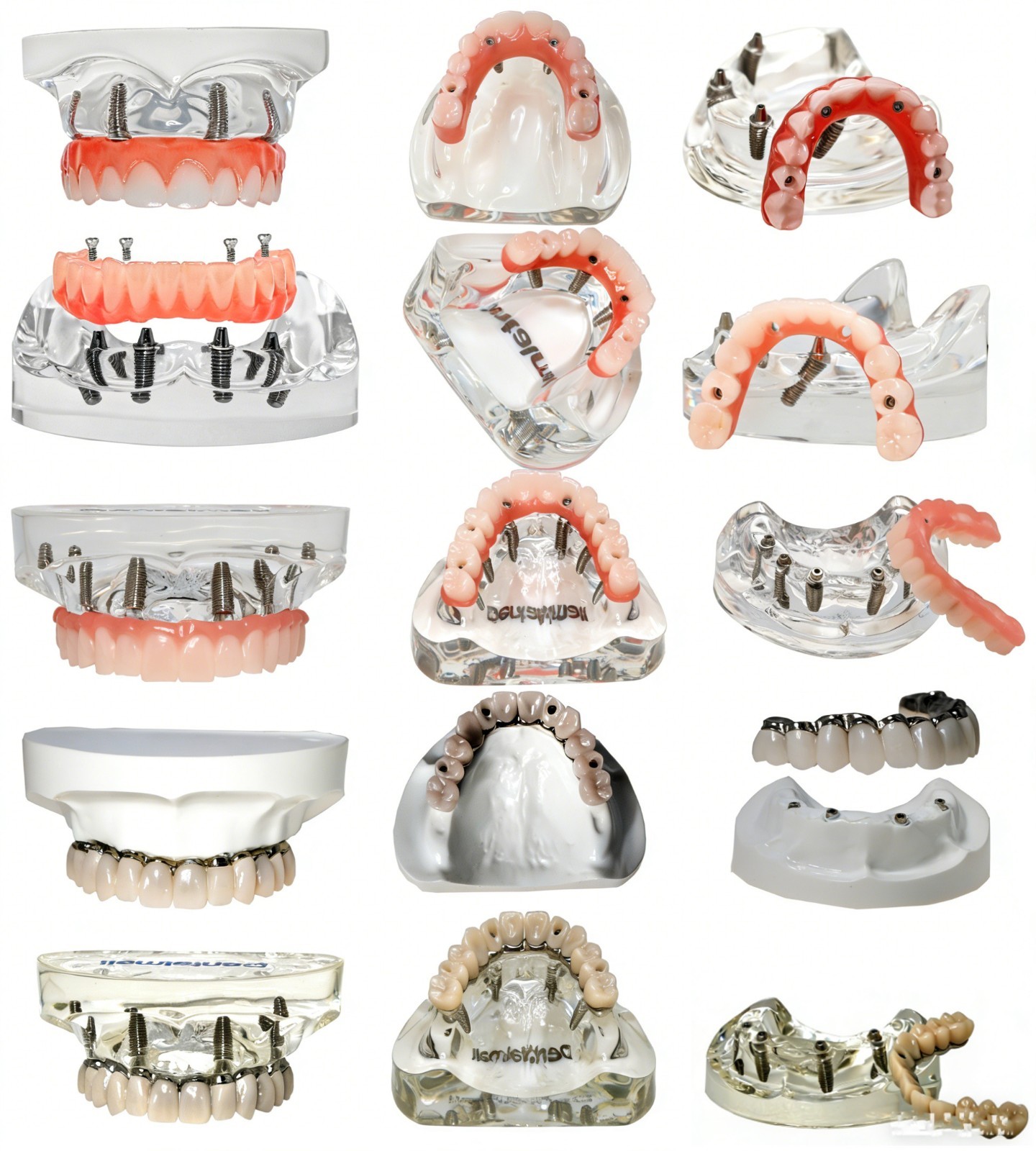 Dental Implant Model Upper Lower Jaw Demo All on 4/6 Overdenture treatment model