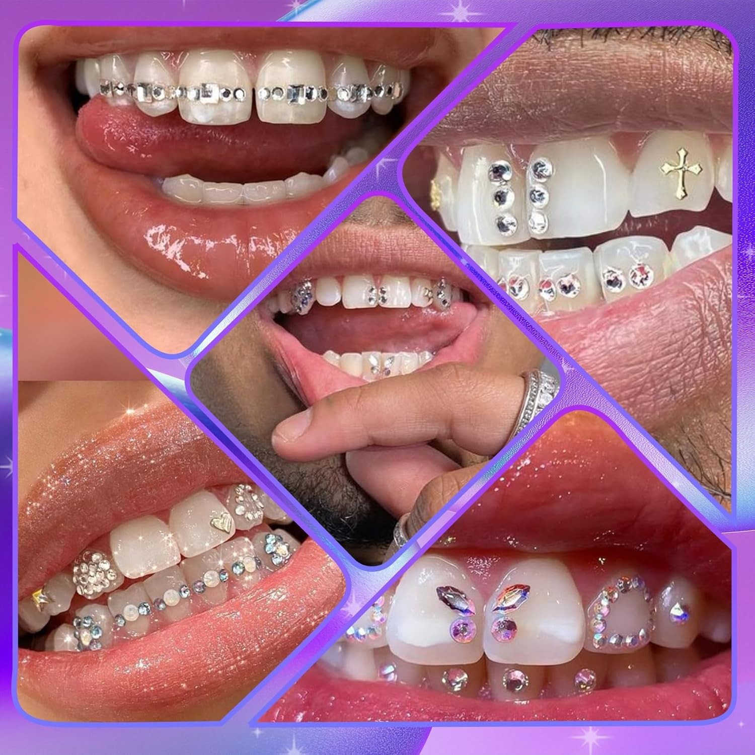 Ultimate DIY Tooth Gem Kit – 247 Crystal Gems for Stunning Smile Transformations