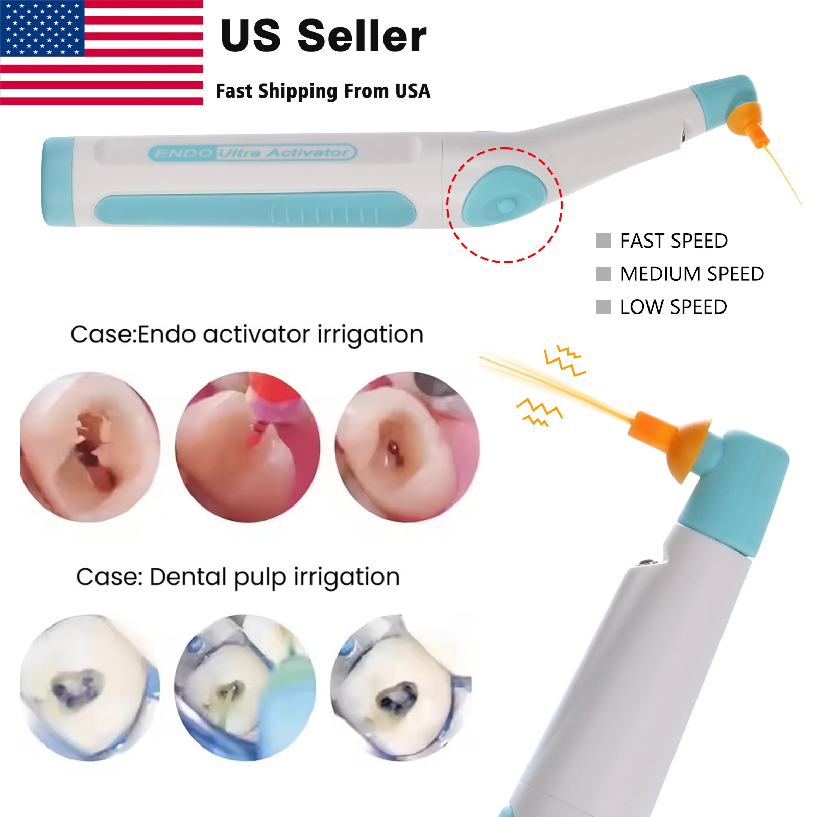 Dental Universal Implant Prosthetic Kit Torque Wrench Screw Drivers Remover pro