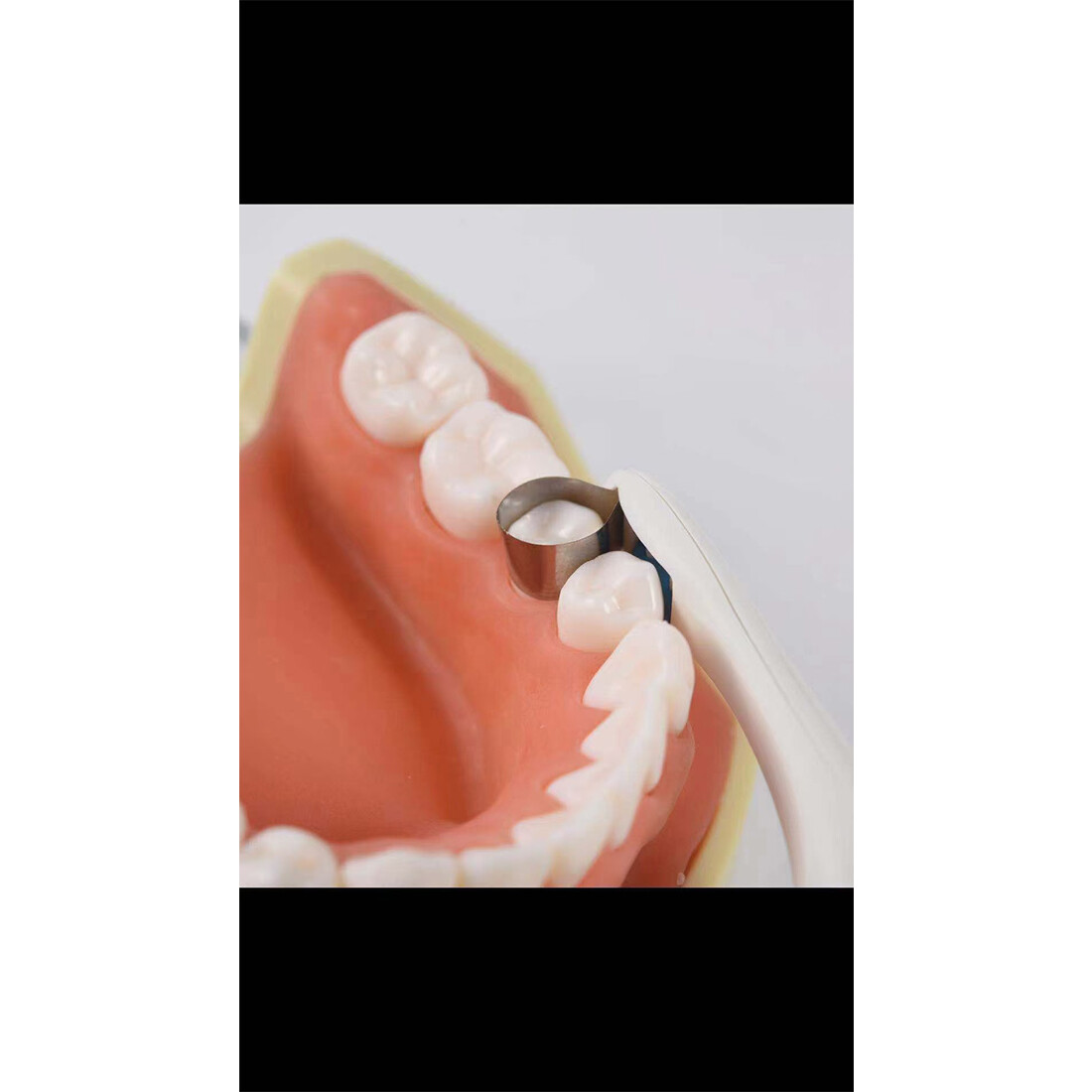 Dental Pro Matrix Bands Molar/Premolar Matrices Adjust Bands Pre Formed 10/50pc