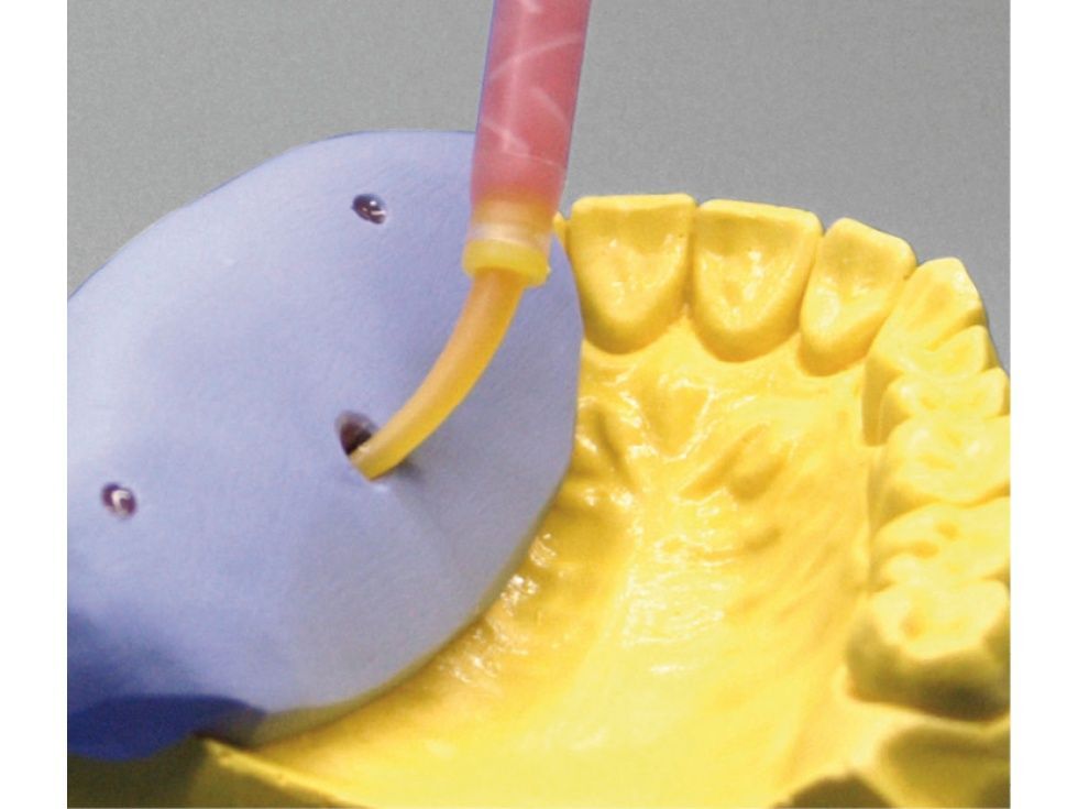 Vincismile Dental Lab Automix Flexible A-Silicone-Based for Gingival Masks