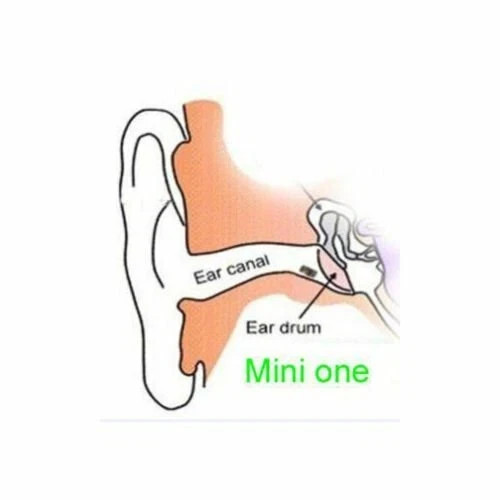 Secret Spy Earphone Micro Listening Device Hearing in Ear Earpiece