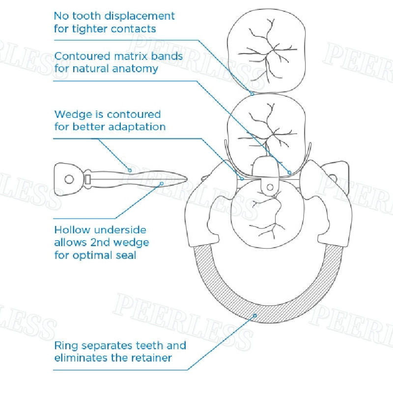 Dental Matrix Bands Ring Sectional Matrice Clamp Fit Garrison Palodent V3 System