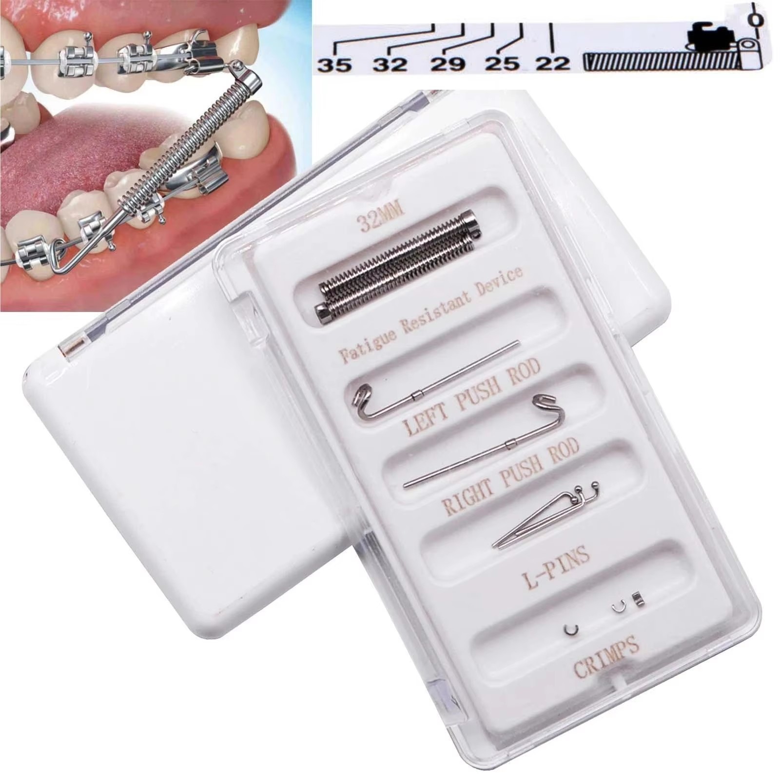 Orthodontic Dental Class II Malocclusion Appliances Fatigue Resistant Device