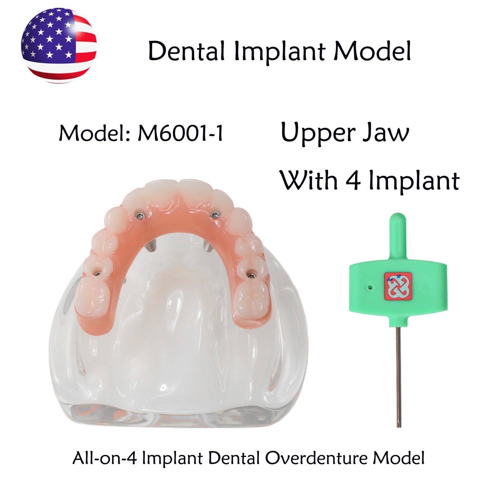 US Dental Implant Overdenture Model All-on-4/6 Upper Jaw Restoration 4/6 Screws