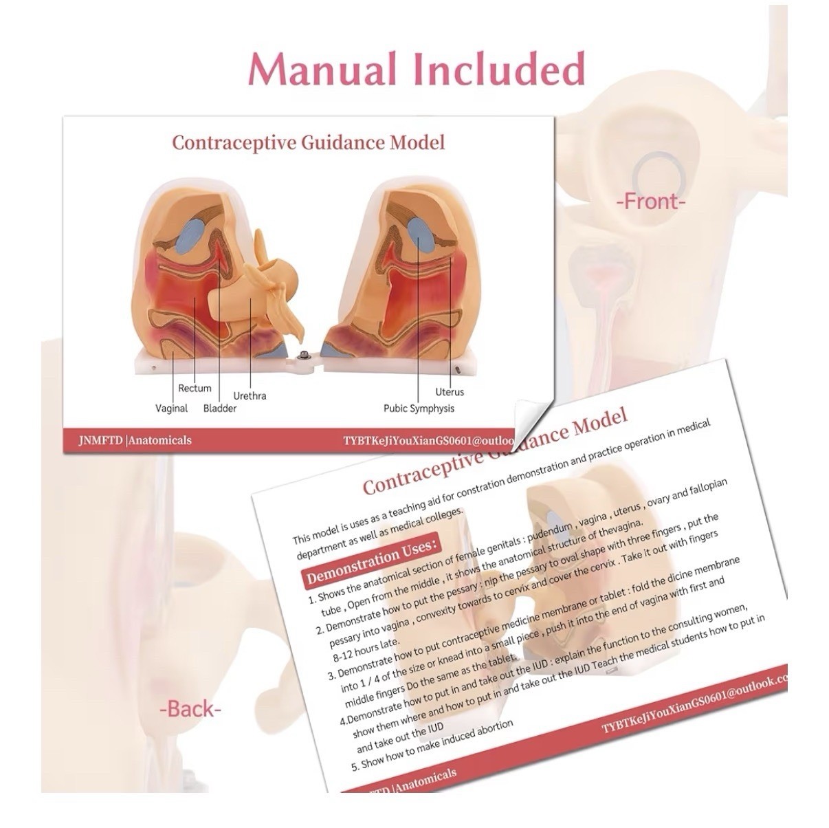 JNMFTD Anatomicals Female Reproductive Contraception Model 5.5″x7.8″, 3.2 lbs