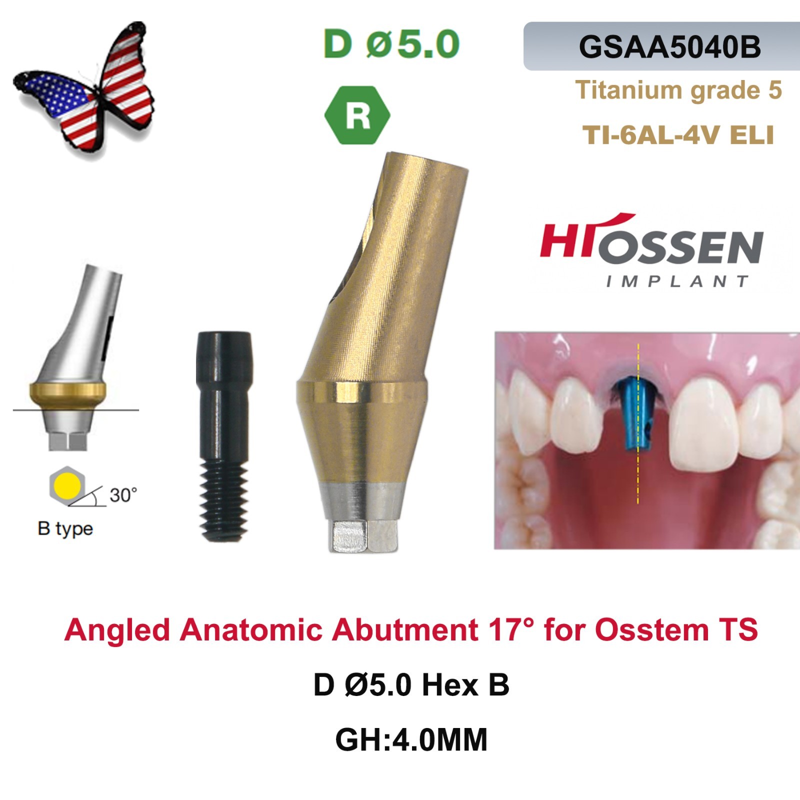 US 17° Angulated Abutment Regular Hex A/B Type For Osstem TS Regular Platform Ti