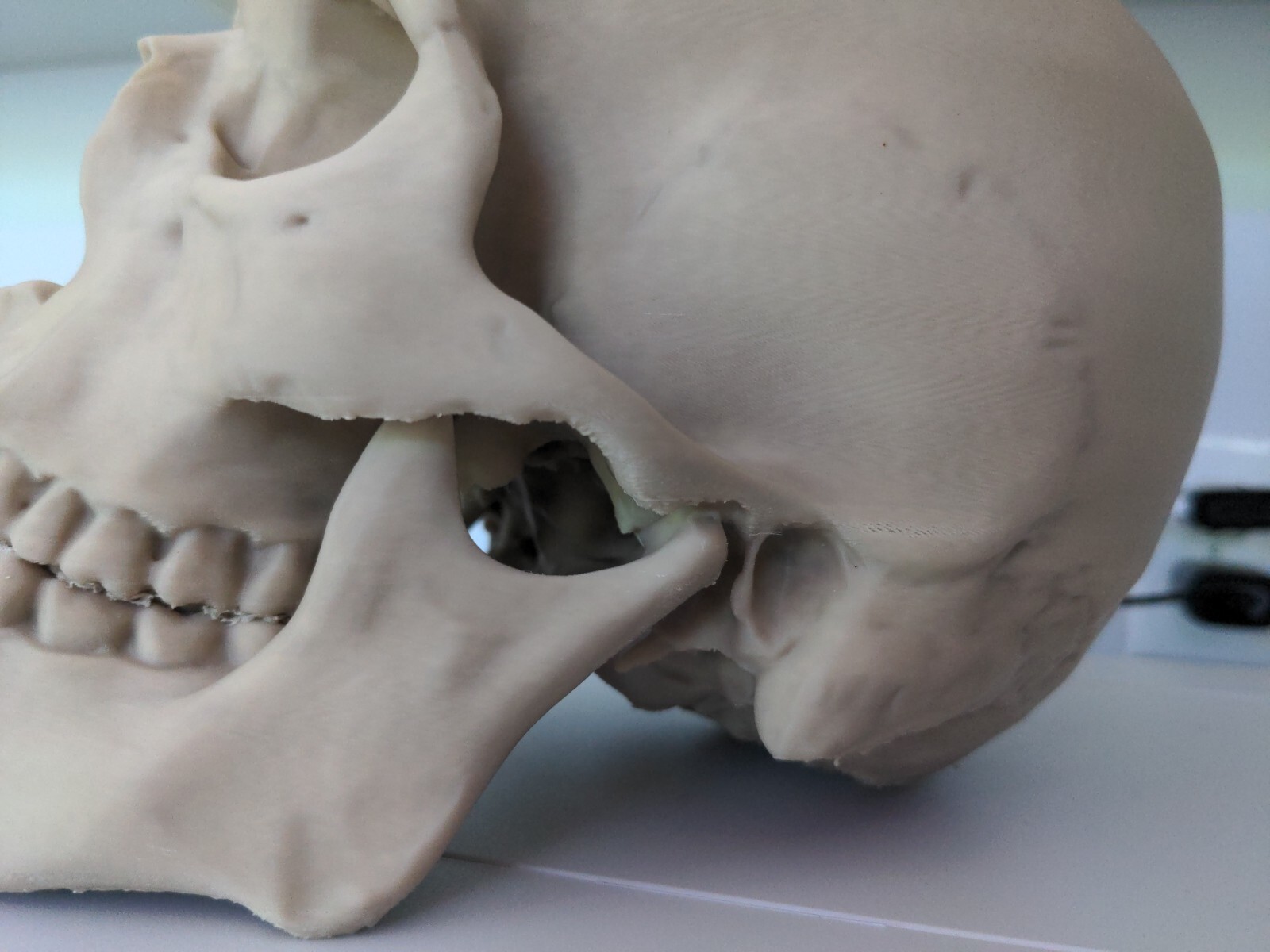 Anatomically Correct Human Skull 3d Printed!