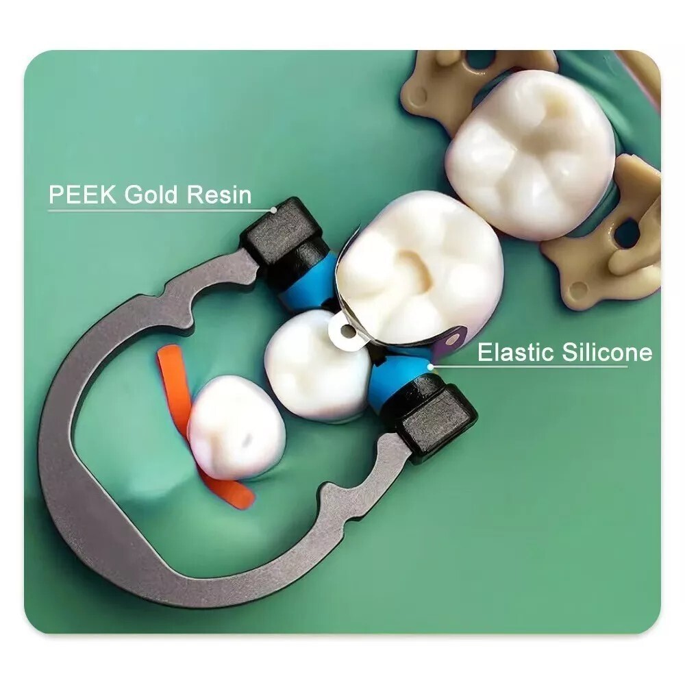 Dental Matrix Sectional Contoured Matrices Nickel Titanium R5 Clamping Ring