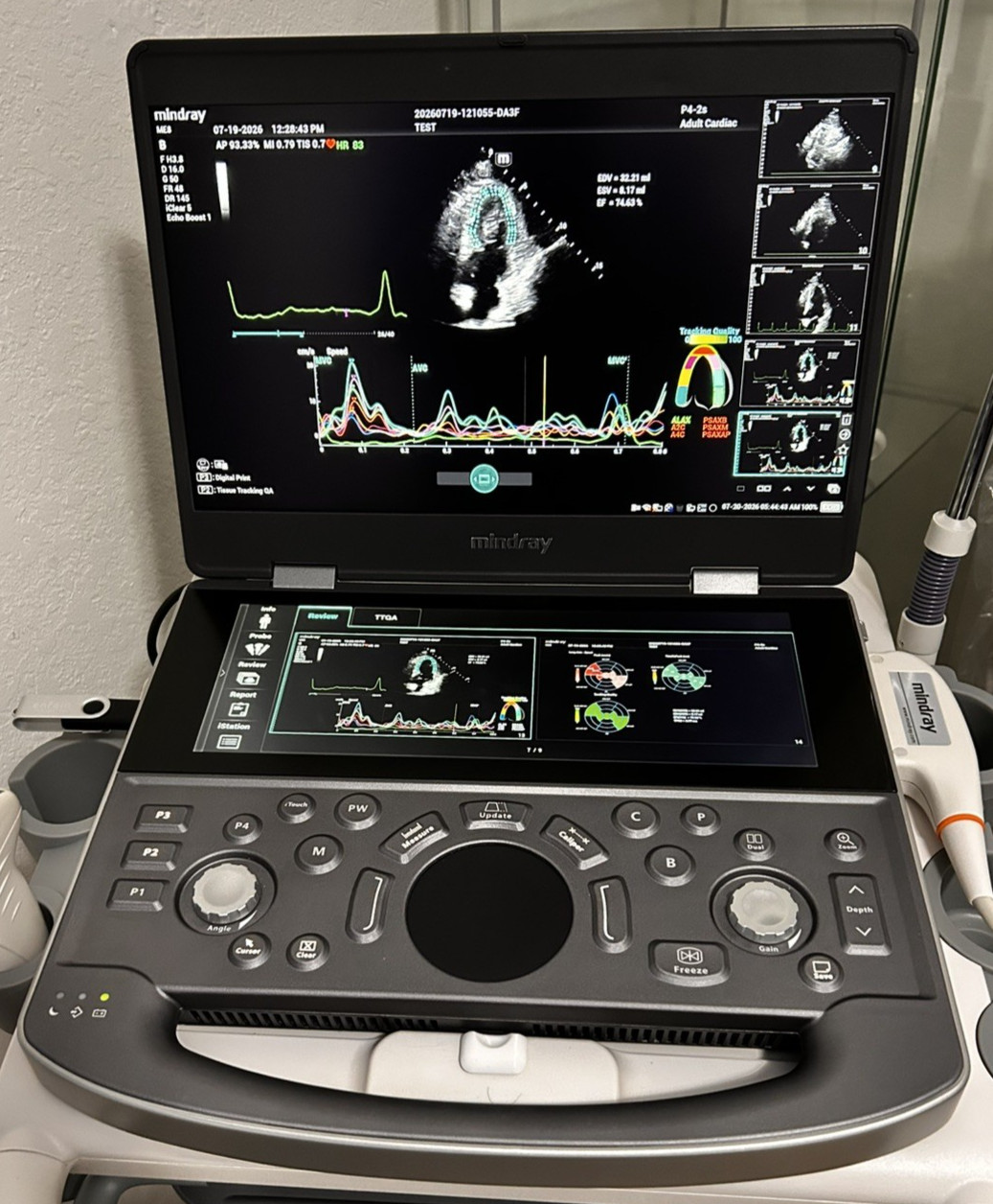Mindray ME8 2021 with Cardiac Probe and all licensed installed