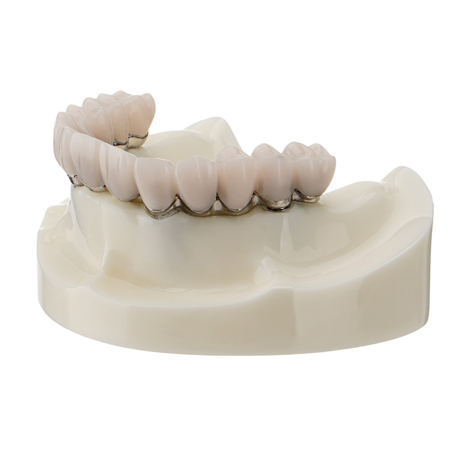 Dental All-on-4 Overdenture Model Upper Jaw Implants Restoration 4 Screws M6023