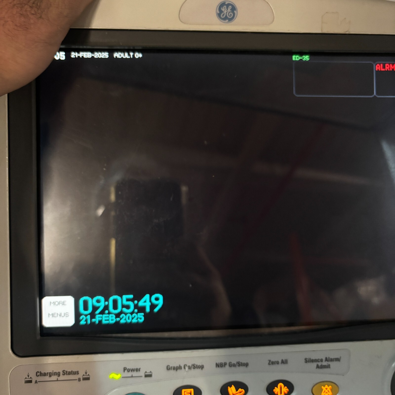 GE Dash 4000 Patient Monitor Vital Signs Display ECG NIBP SpO2 100-240V ✅