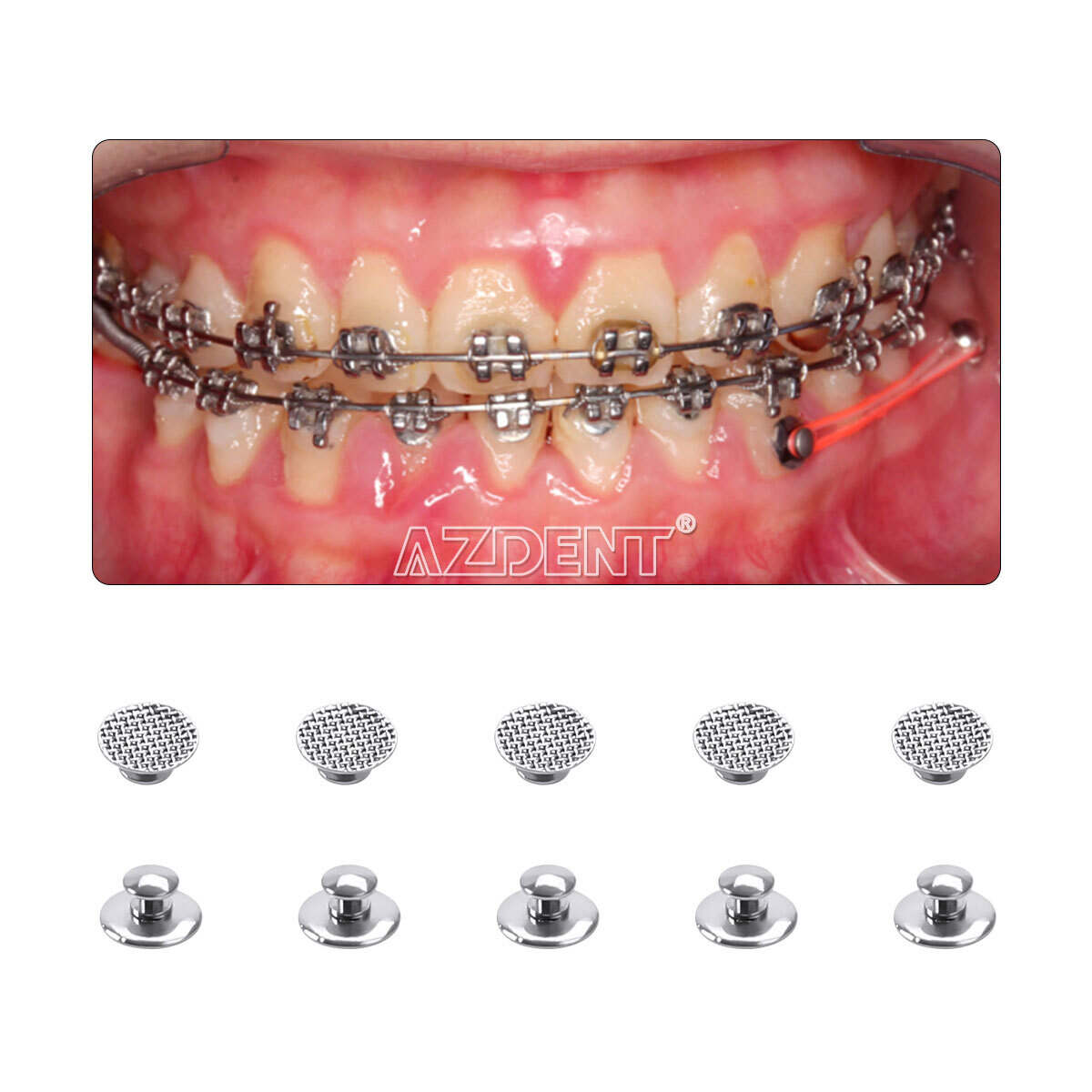 10pc AZDENT Dental Orthodontic Bondable Round Lingual Buttons Mesh Base