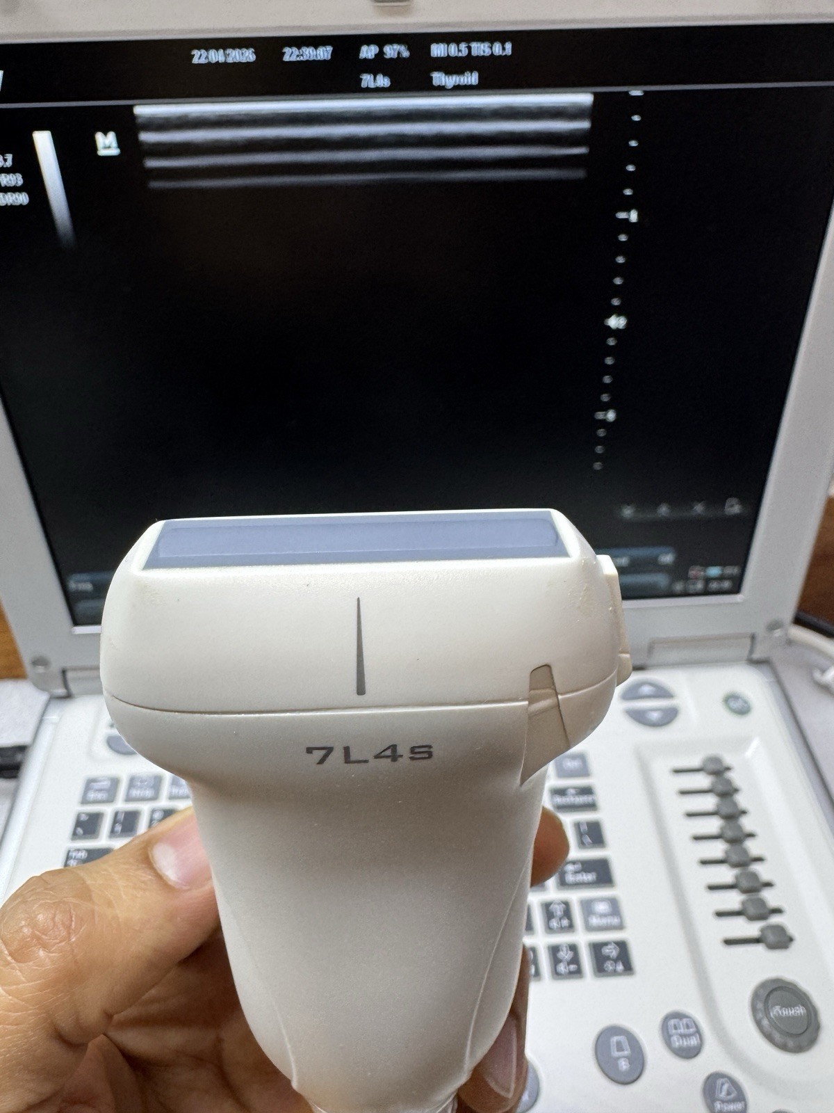 Mindray M7 With Linear Transducer 7L4S (YOU WILL RECEIVE WHAT IS IN THE PICTURE)
