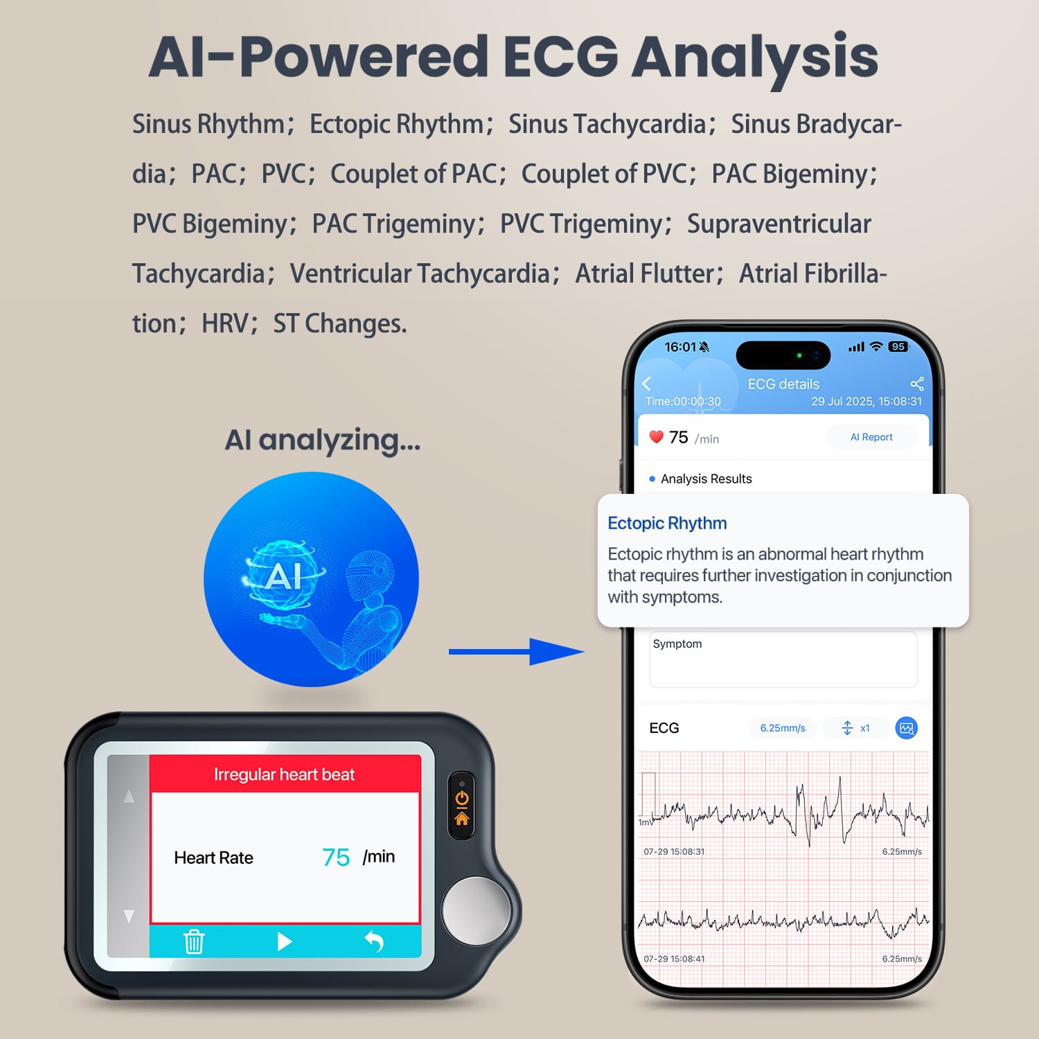 Home EKG Monitor with External Cable, 30s/60s/5min Recording + AI ECG Analysis
