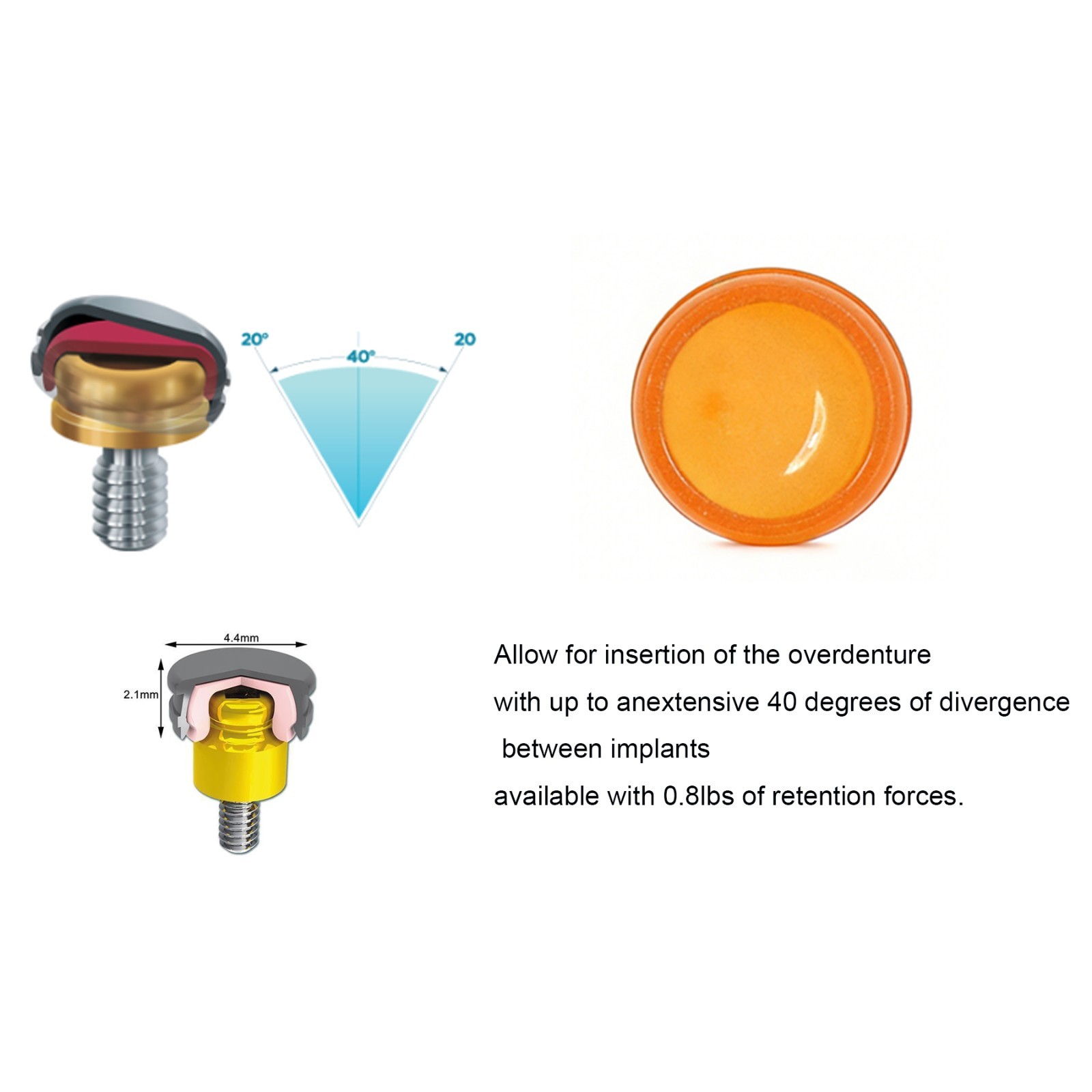 US Dental Attachment Locator Abutment for HIOSSEN ET ZEST Legacy anchor OSS