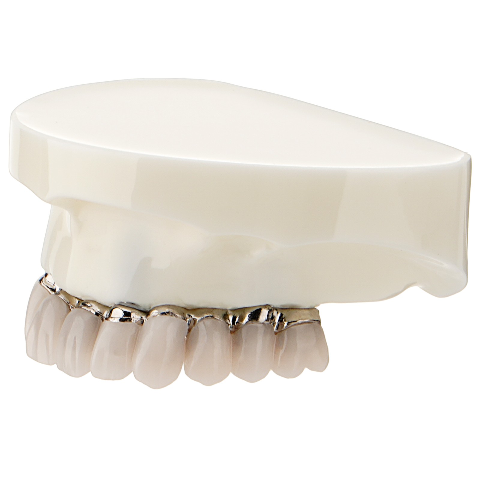 Dental All-on-4 Overdenture Model Upper Jaw Implants Restoration 4 Screws M6023